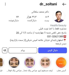 پیج اینستاگرام دکتر محمدسلطانی، بوتاکس اصفهان